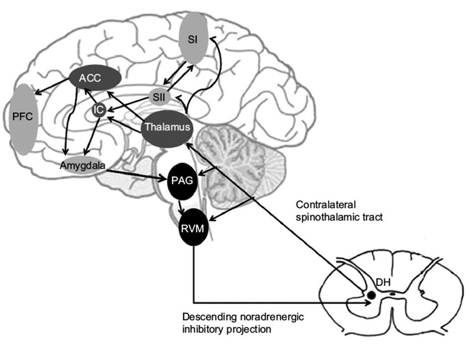 cerebro percibe el dolor.