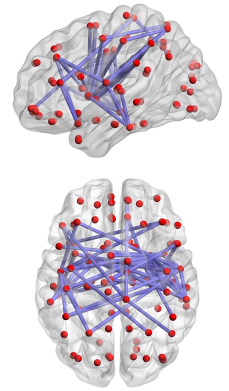 Conexiones cerebrales.